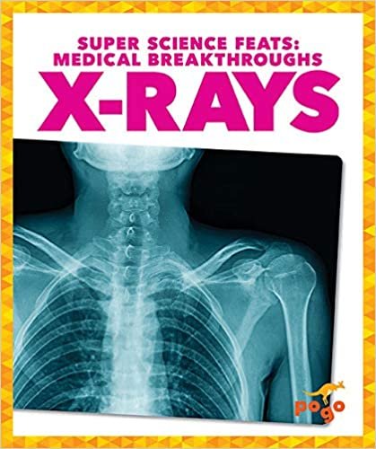 indir X-Rays (Super Science Feats: Medical Breakthroughs)