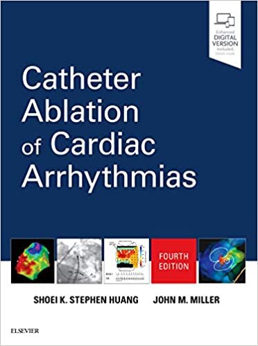 indir Catheter Ablation of Cardiac Arrhythmias