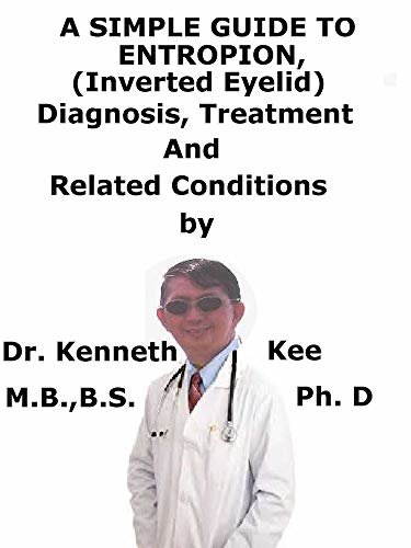 ダウンロード  A Simple Guide To Entropion, (Inverted Eyelid) Diagnosis, Treatment And Related Conditions (English Edition) 本