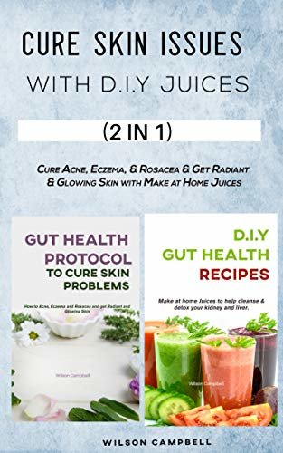 CURE SKIN ISSUES WITH D.I.Y JUICES : Cure Acne, Eczema, & Rosacea & Get Radiant & Glowing Skin with Make at Home Juices (English Edition)