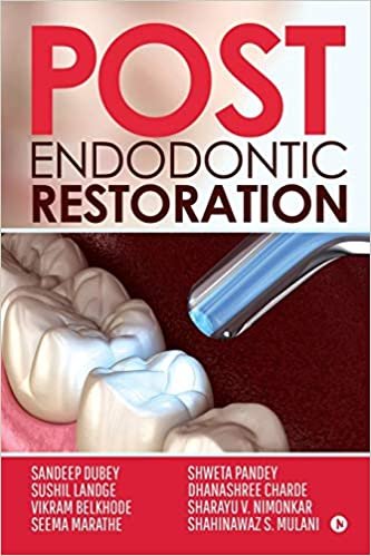 اقرأ Post Endodontic Restoration الكتاب الاليكتروني 