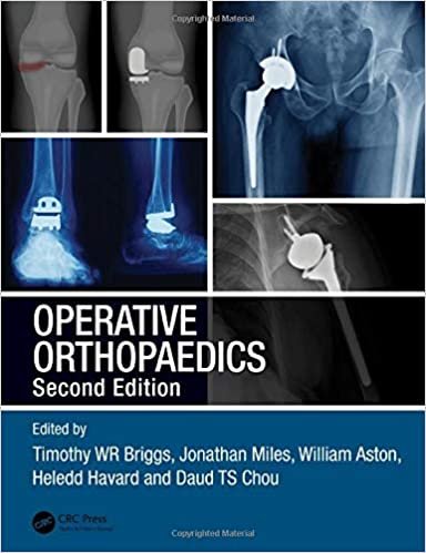 ダウンロード  Operative Orthopaedics 本