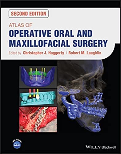 تحميل Atlas of Operative Oral and Maxillofacial Surgery