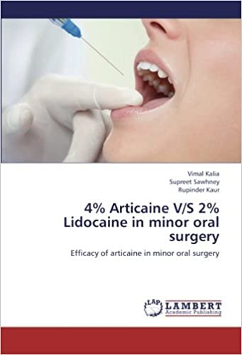 4% Articaine V/S 2% Lidocaine in minor oral surgery: Efficacy of articaine in minor oral surgery indir