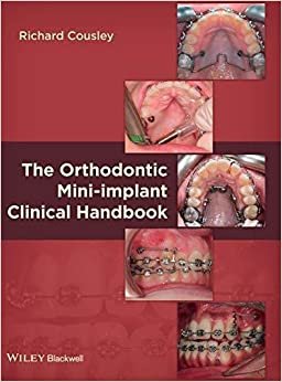 Richard Cousley The Orthodontic Mini-implant Clinical Handbook تكوين تحميل مجانا Richard Cousley تكوين