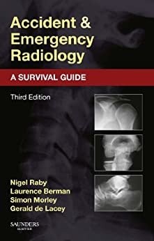 Accident and Emergency Radiology: A Survival Guide (English Edition)