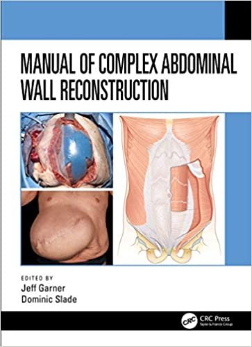 Manual of Complex Abdominal Wall Reconstruction ダウンロード