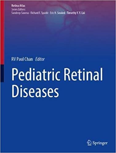 تحميل Pediatric Retinal Diseases
