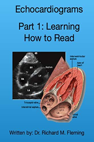 Echocardiograms - Part 1: Understanding the Basics. (English Edition) ダウンロード