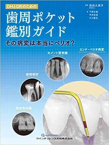 ダウンロード  DHとDRのための歯周ポケット鑑別ガイド 本