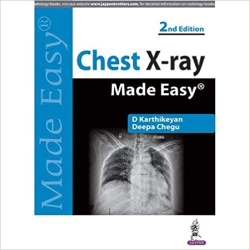 ‎Chest Xray Made Easy With Photo Cdrom ‎2‎E‎