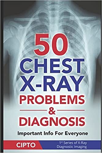 تحميل 50 Chest X-Ray Problems &amp; Diagnosis: Important Info For Everyone (X-Ray Diagnostic Imaging)