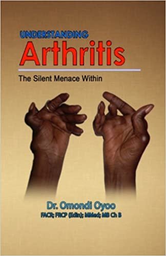 Understanding Arthritis: The Silent Menace Within