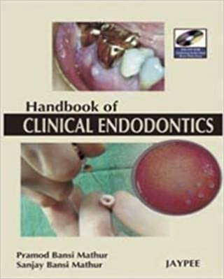  بدون تسجيل ليقرأ A Hand Book of Clinical Endodontics
