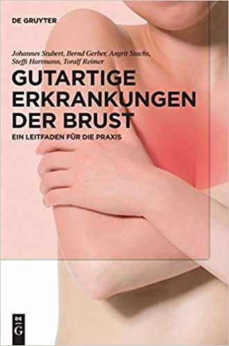 اقرأ Gutartige Erkrankungen der Brust الكتاب الاليكتروني 