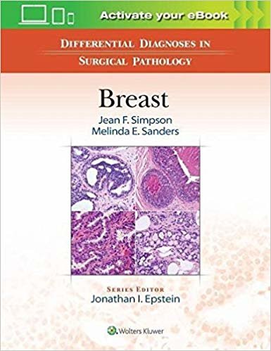 indir Differential Diagnoses in Surgical Pathology: Breast