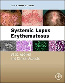 George Tsokos Systemic Lupus Erythematosus: Basic, Applied and Clinical Aspects By Parragon Books تكوين تحميل مجانا George Tsokos تكوين