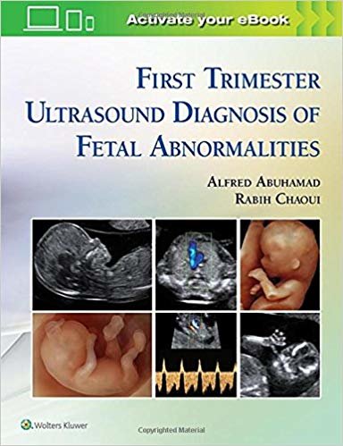 indir First Trimester Ultrasound Diagnosis of Fetal Abnormalities