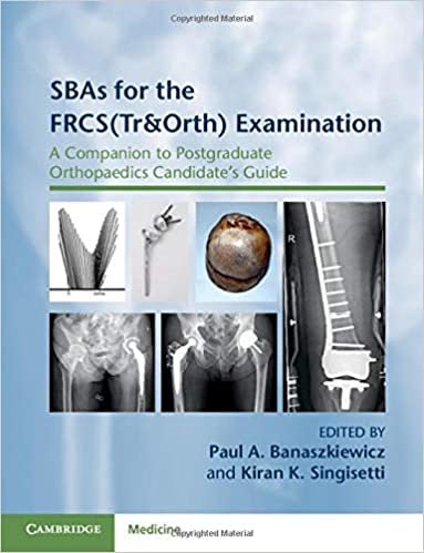 SBAs for the FRCS(Tr&Orth) Examination: A Companion to Postgraduate Orthopaedics Candidate's Guide indir