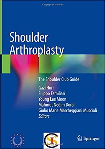 اقرأ Shoulder Arthroplasty: The Shoulder Club Guide الكتاب الاليكتروني 