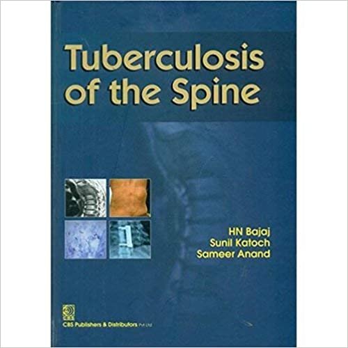  بدون تسجيل ليقرأ Tuberculosis of the Spine