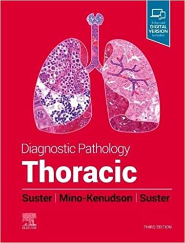 اقرأ Diagnostic Pathology: Thoracic الكتاب الاليكتروني 