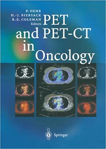 indir PET and PET-CT in Oncology