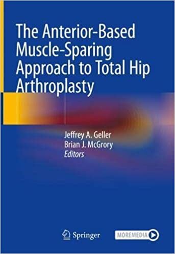 تحميل The Anterior-Based Muscle-Sparing Approach to Total Hip Arthroplasty