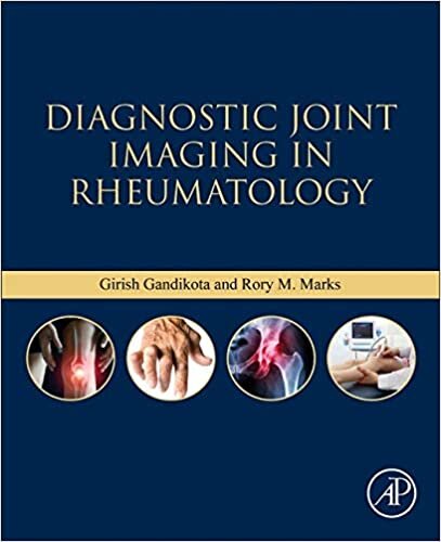 ダウンロード  Diagnostic Joint Imaging in Rheumatology 本