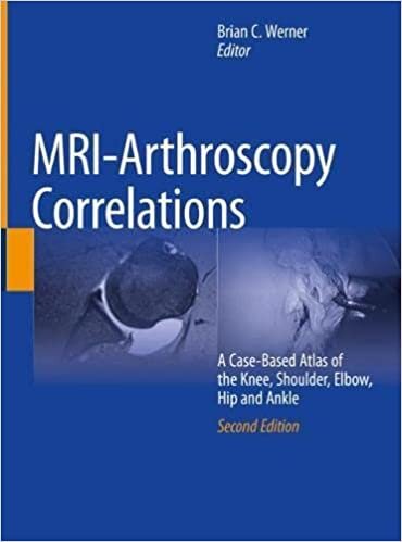 تحميل MRI-Arthroscopy Correlations: A Case-Based Atlas of the Knee, Shoulder, Elbow, Hip and Ankle