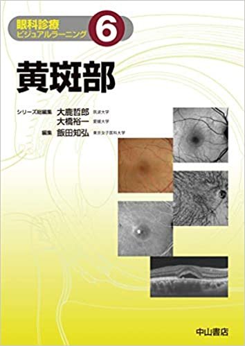 黄斑部 (眼科診療ビジュアルラーニング) ダウンロード