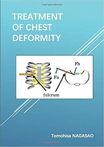 Treatment of Chest Deformity: A Guidebook for patients (MyISBN - デザインエッグ社)
