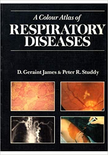  بدون تسجيل ليقرأ A Colour Atlas of Respiratory Diseases