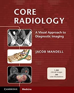 Core Radiology: A Visual Approach to Diagnostic Imaging (English Edition)