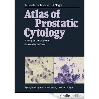 Atlas of Prostatic Cytology: Techniques and Diagnosis [Kindle-editie] beoordelingen