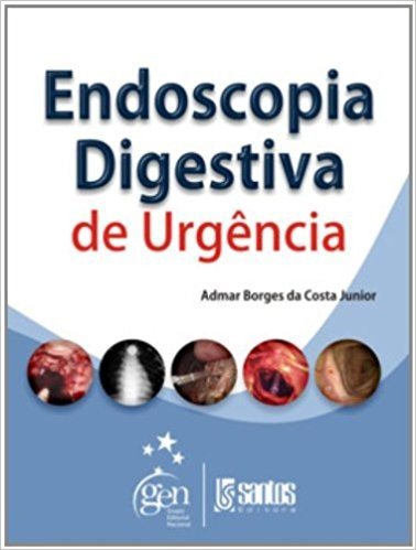 Endoscopia Digestiva De Urgência