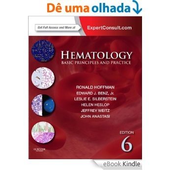 Hematology: Diagnosis and Treatment (Hematology Basic Principles and Practice) [eBook Kindle]