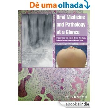 Oral Medicine and Pathology at a Glance (At a Glance (Dentistry)) [eBook Kindle] baixar
