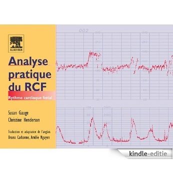 Analyse pratique du RCF: Rythme cardiaque fœtal [Kindle-editie]