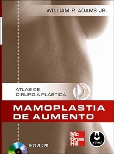 Atlas de Cirurgia Plástica. Mamoplastia de Aumento