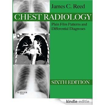 Chest Radiology Plain Film Patterns and Differential Diagnoses (Expert Consult Title: Online + Print) [Kindle-editie]