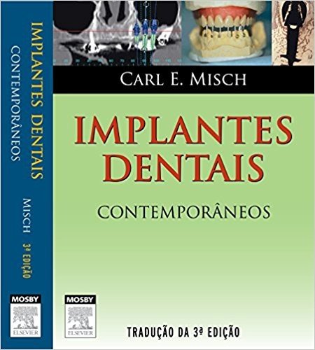 Implantes Dentais Contemporâneos
