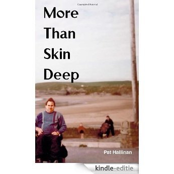 More Than Skin Deep [Kindle-editie]
