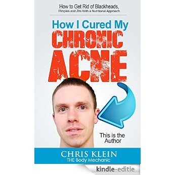 How I Cured My Chronic Acne: How to Get Rid of Blackheads, Pimples and Zits With a Nutritional Approach: The truth about acne, acne remedy, acne free, ... diet, plus free books! (English Edition) [Kindle-editie]