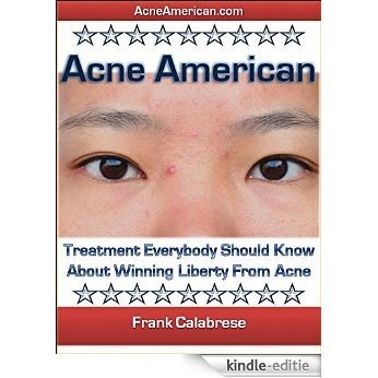 Acne American: Treatment Everybody Should Know About Winning Liberty From Acne (English Edition) [Kindle-editie]