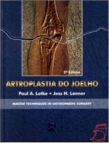 Artroplastia Do Joelho. Master Techniques In Orthopaedic