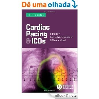 Cardiac Pacing and ICDs [eBook Kindle]