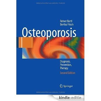 Osteoporosis [Kindle-editie]