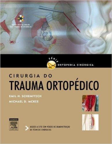 Cirurgia do Trauma Ortopédico