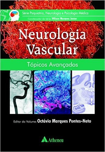 Neurologia Vascular